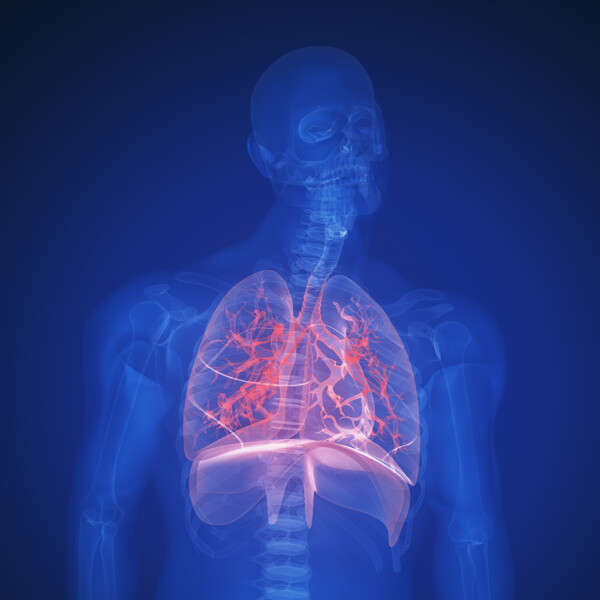 肺部X光图像图片
