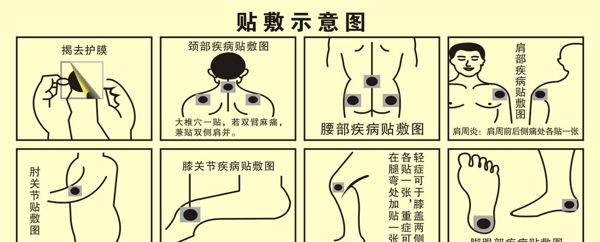 貼敷示意圖圖片