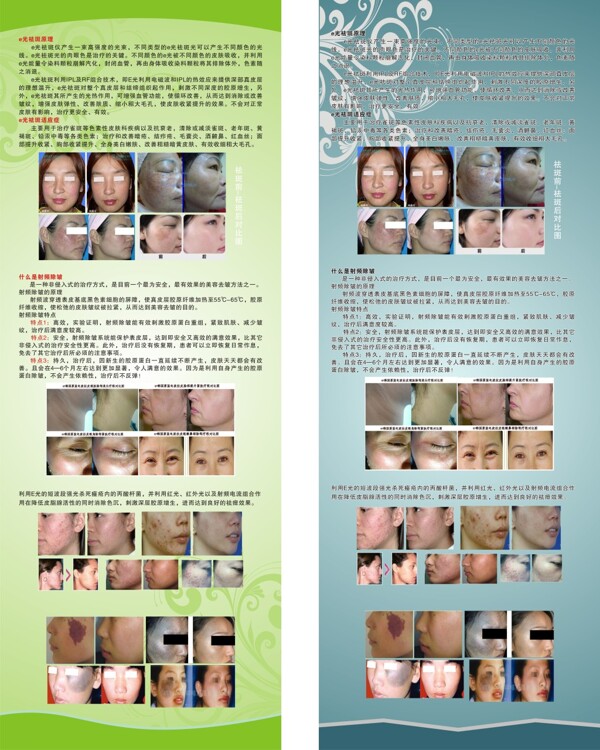祛痘X展架