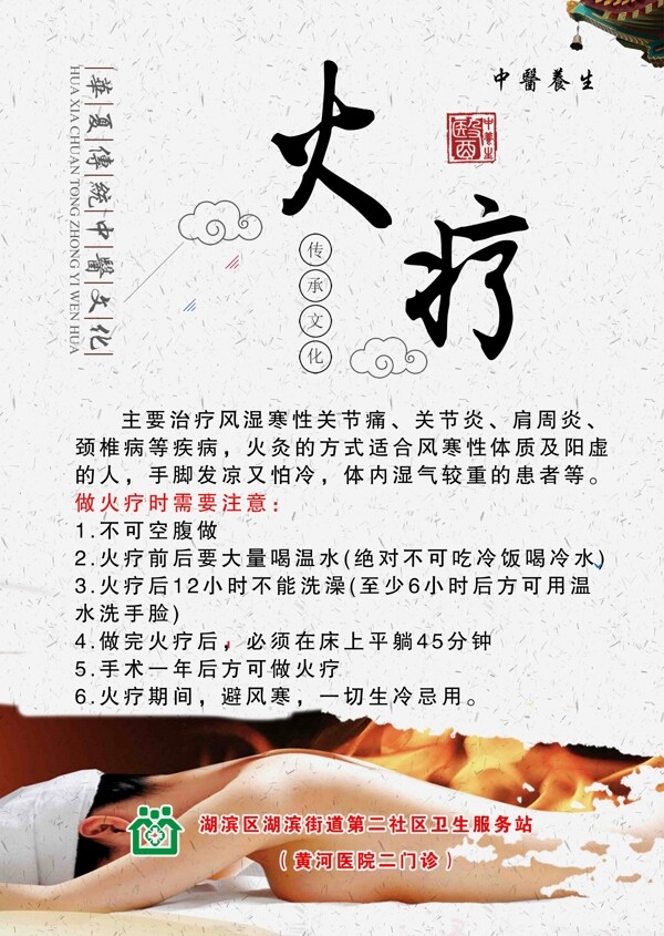 火療