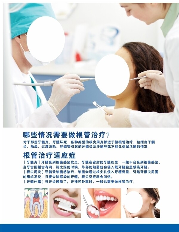 牙科根管治疗图片