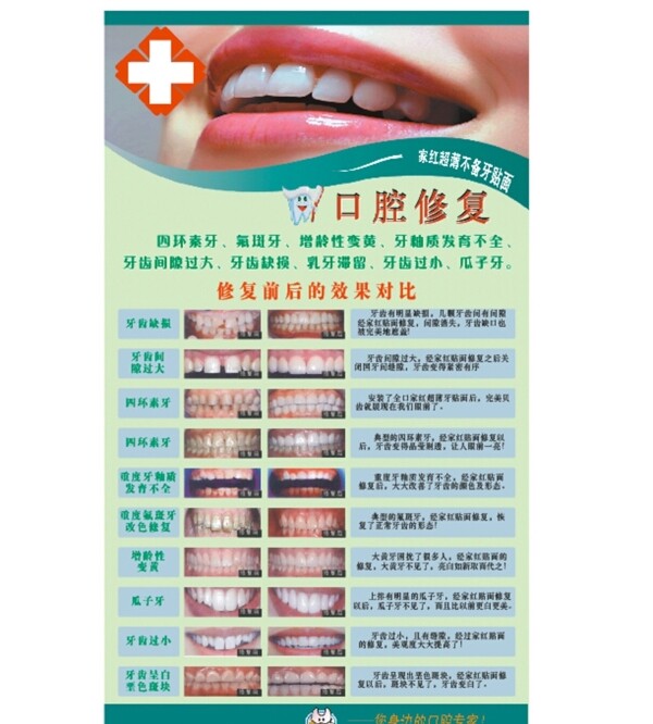 诊所医院宣传牌牙齿牙科牙齿修复图片