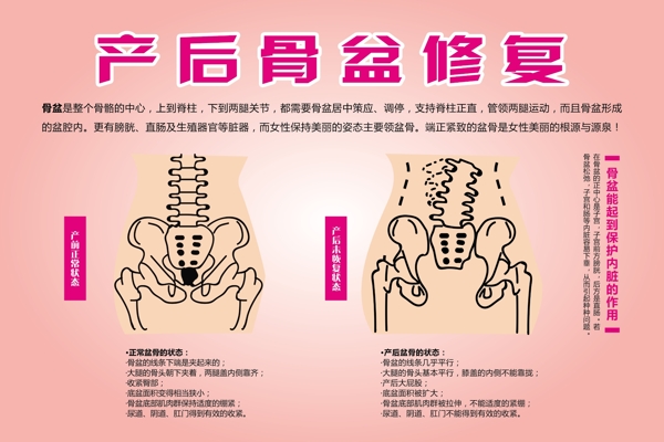 产后修复