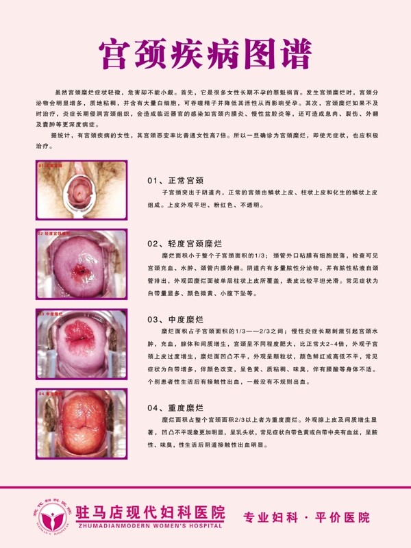 宫颈疾病图谱图片