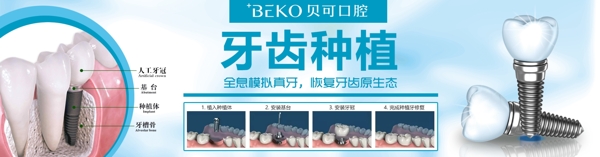 牙科口腔诊所种植牙喷绘网站横幅