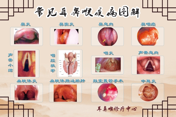 耳鼻喉症状图图片